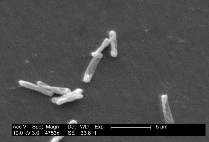 Clostridioides difficile